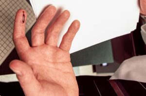 Порез бумагой